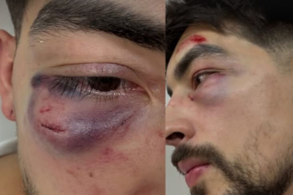 empresario-denuncia-agressao-por-funcionarios-de-karaoke-em-sao-paulo