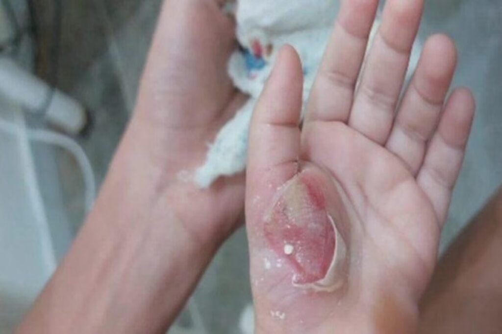 conselho-tutelar-encontra-bebe-ferido;-mae-e-presa-por-tortura