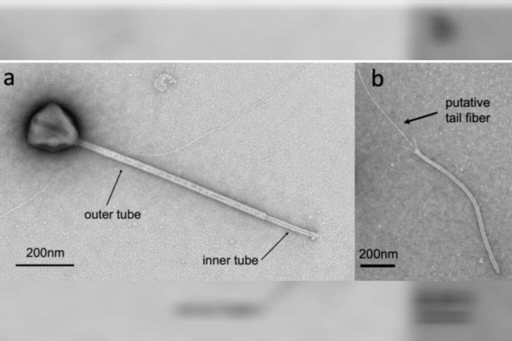 cientistas-encontram-virus-com-a-cauda-mais-longa-ja-observada