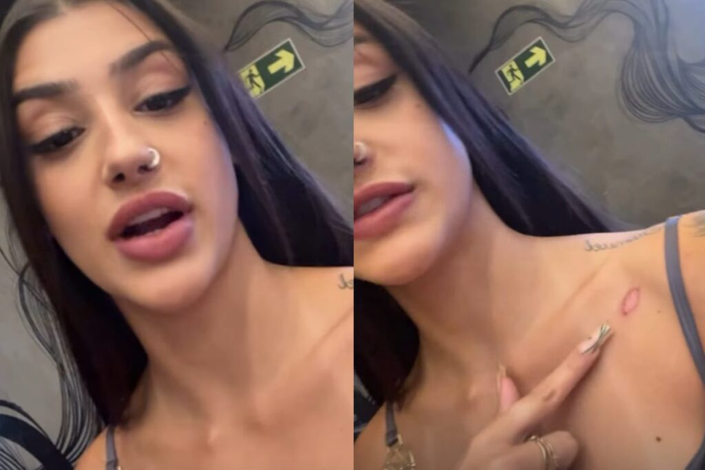 bia-miranda-mostra-ferimento-apos-acidente