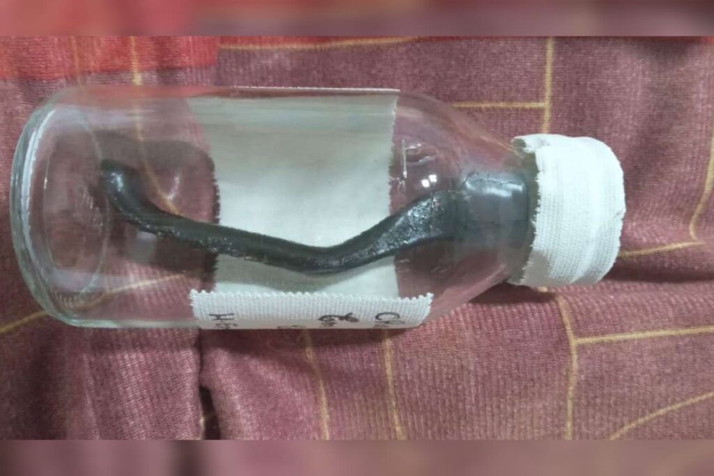 ciclista-atropelado-fica-9-meses-com-peca-de-bicicleta-na-barriga