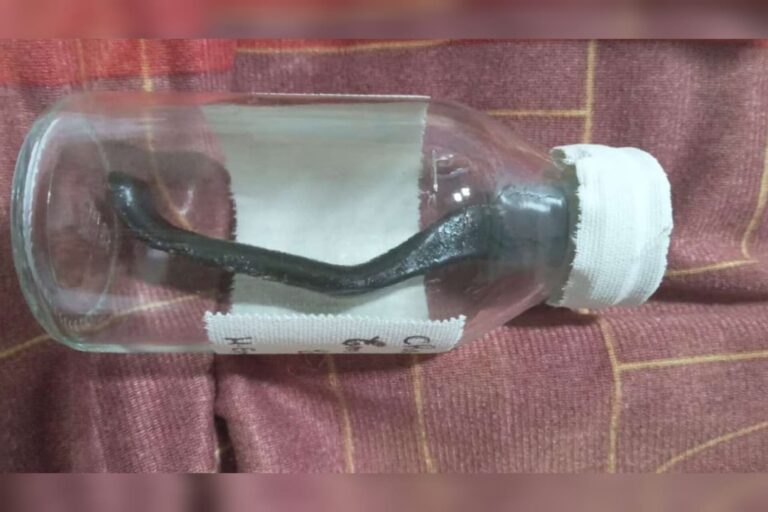 ciclista-atropelado-fica-9-meses-com-peca-de-bicicleta-na-barriga