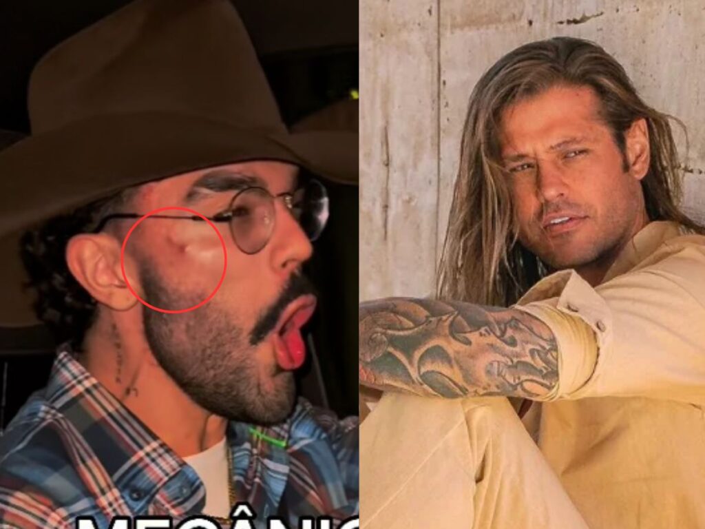 luan-pereira-surge-com-o-rosto-machucado-apos-confusao-com-dado-dolabella