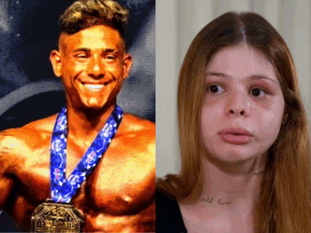 “nao-e-possivel-que-essa-sou-eu”,-diz-medica-que-teve-rosto-desfigurado-pelo-namorado