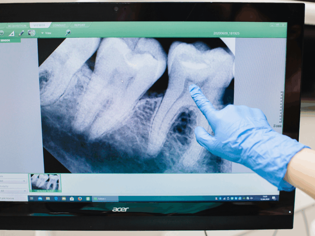 fungo-no-dente-e-gravidez:-entenda-o-diagnostico-que-atinge-maira-cardi