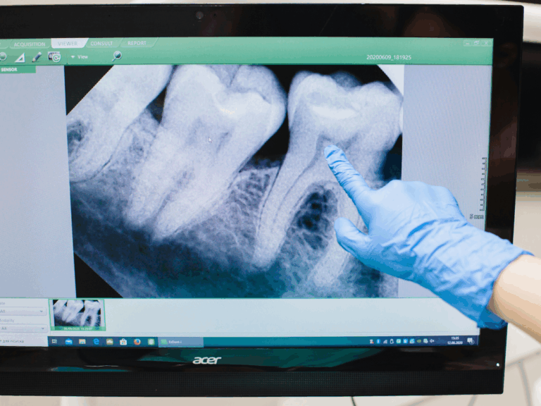 fungo-no-dente-e-gravidez:-entenda-o-diagnostico-que-atinge-maira-cardi
