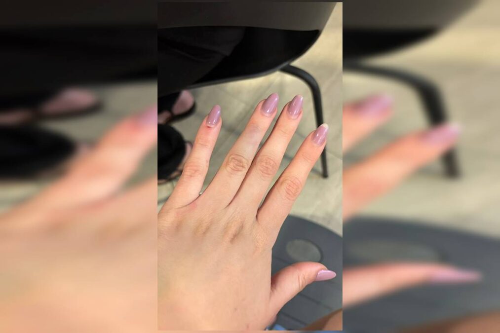 Menina que pulou de carro de app por medo de estupro: “Traumatizada”