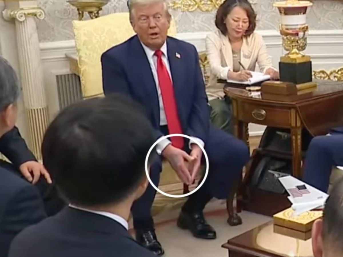 Trump e o diagnóstico de doença venosa: entenda o quadro de saúde do presidente dos EUA
