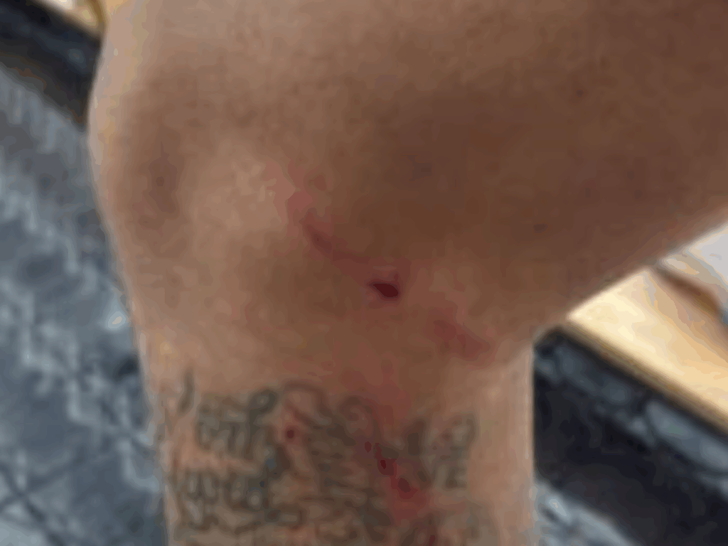 “toda-vez-isso”:-neymar-exibe-ferimento-no-joelho-e-protesta-contra-o-var