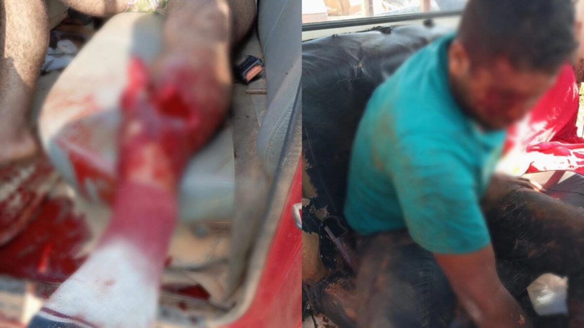Colisão entre moto e Toyota deixa homem com fratura exposta no Ramal do Paraíso, em Sena Madureira