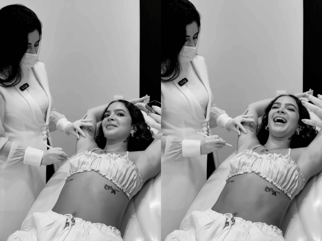 suor-excessivo:-especialista-explica-uso-de-botox-para-tratar-condicao-de-mel-maia