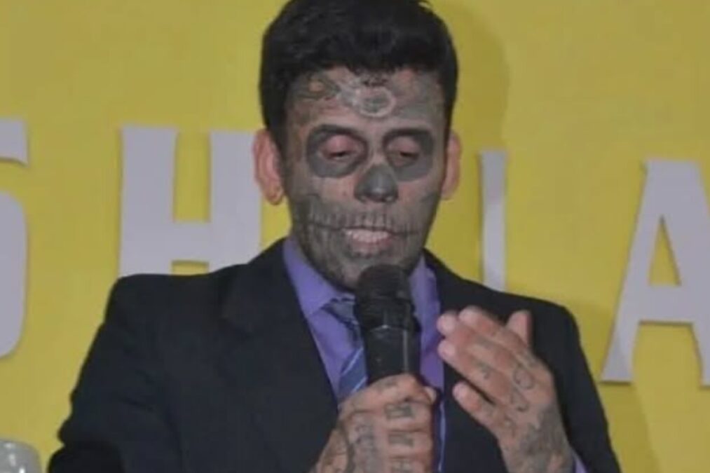 Homem “mais tatuado do Brasil” remove tatuagens do rosto; veja