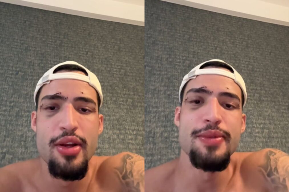 Ator se pronuncia pela 1ª vez após ser achado desacordado na Grécia