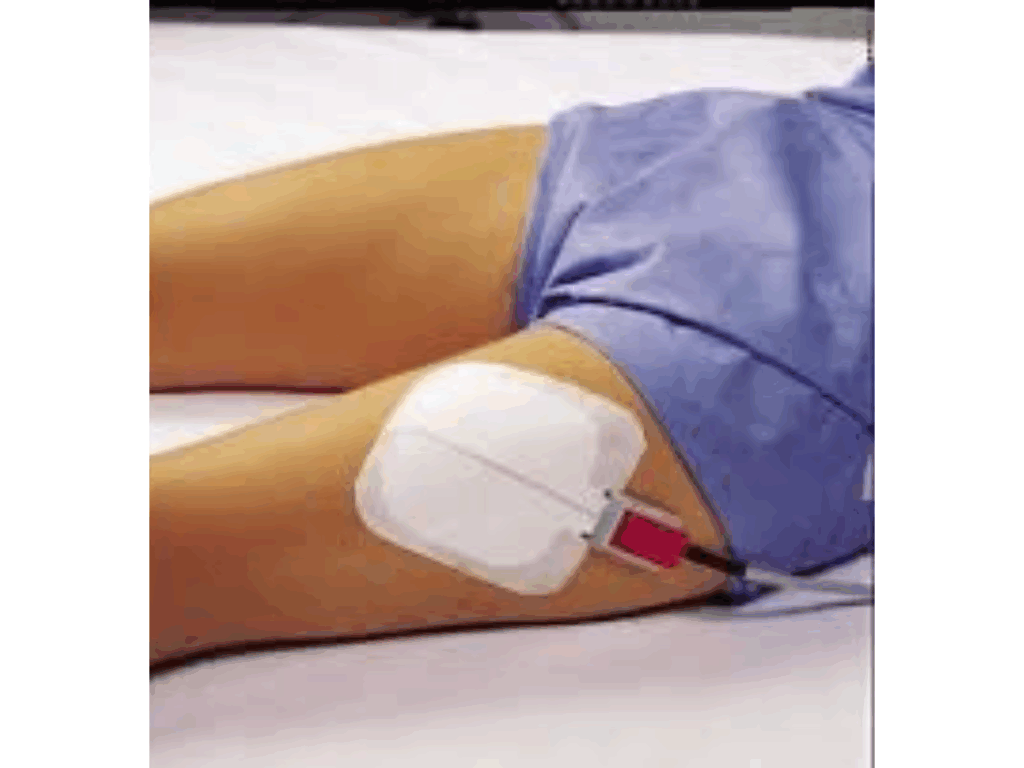 queimadura-de-3o-grau-com-bisturi-eletrico:-cirurgiao-analisa-caso-de-ex-a-fazenda