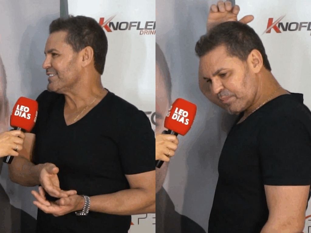 eduardo-costa-revela-pre-depressao-e-queda-de-cabelo,-e-detalha-implante-capilar