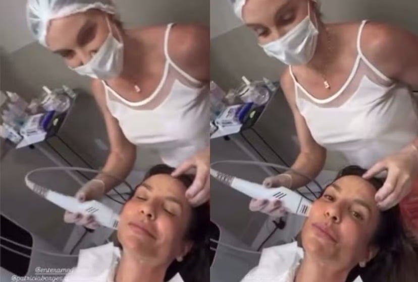 especialista-explica-tecnica-coreana-de-r$-9-mil-que-conquistou-ivete-sangalo