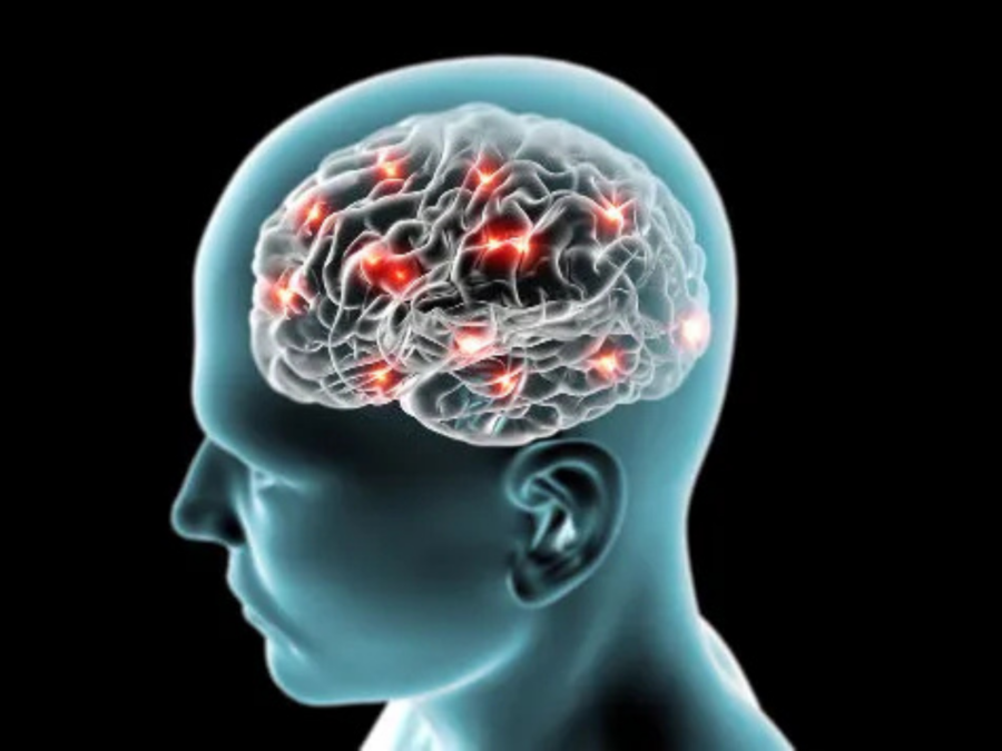 Mulheres têm até três vezes mais risco de aneurisma cerebral, alerta especialista