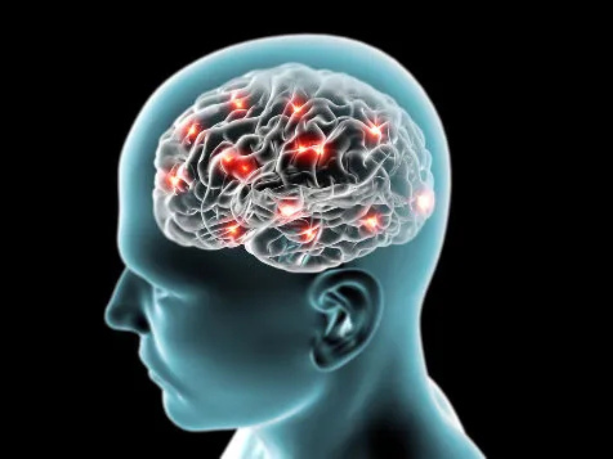 Mulheres têm até três vezes mais risco de aneurisma cerebral, alerta especialista