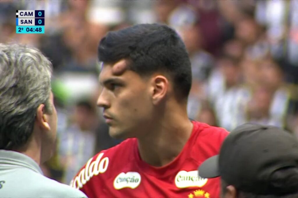 brazao,-do-santos,-deixa-campo-de-maca-apos-joelhada-na-cabeca