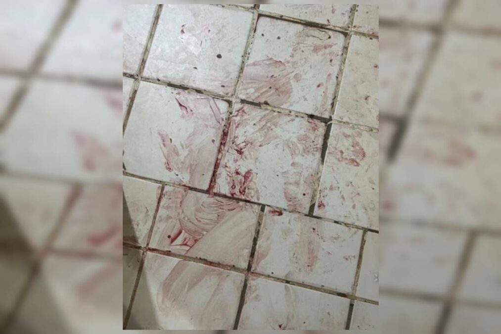 Filho espancado pelo pai na Asa Norte tentou defender mãe de agressão