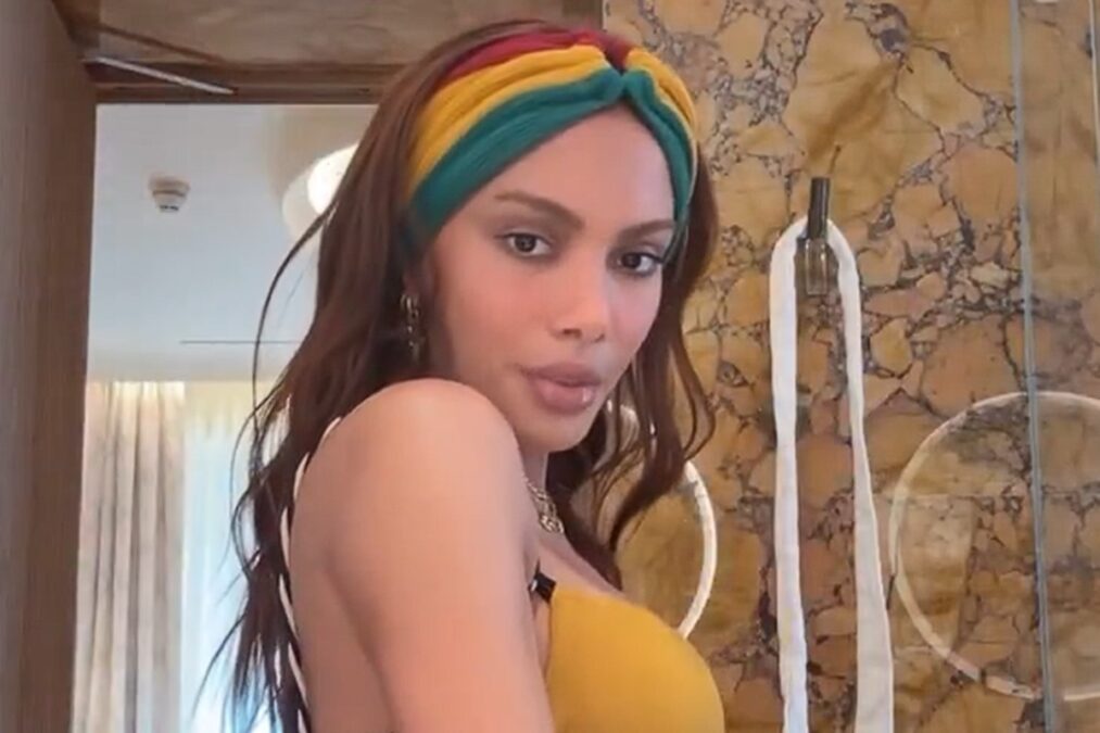 Anitta reage a críticas sobre “novo rosto” após procedimentos: vídeo