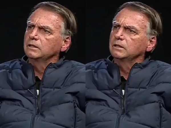 carcinoma-de-celulas-escamosas:-especialista-explica-cancer-diagnosticado-em-bolsonaro