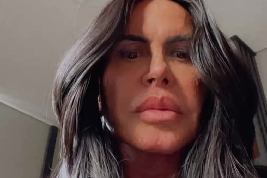 gretchen-revela-uso-de-cannabis-para-tratamento-e-elogia-experiencia