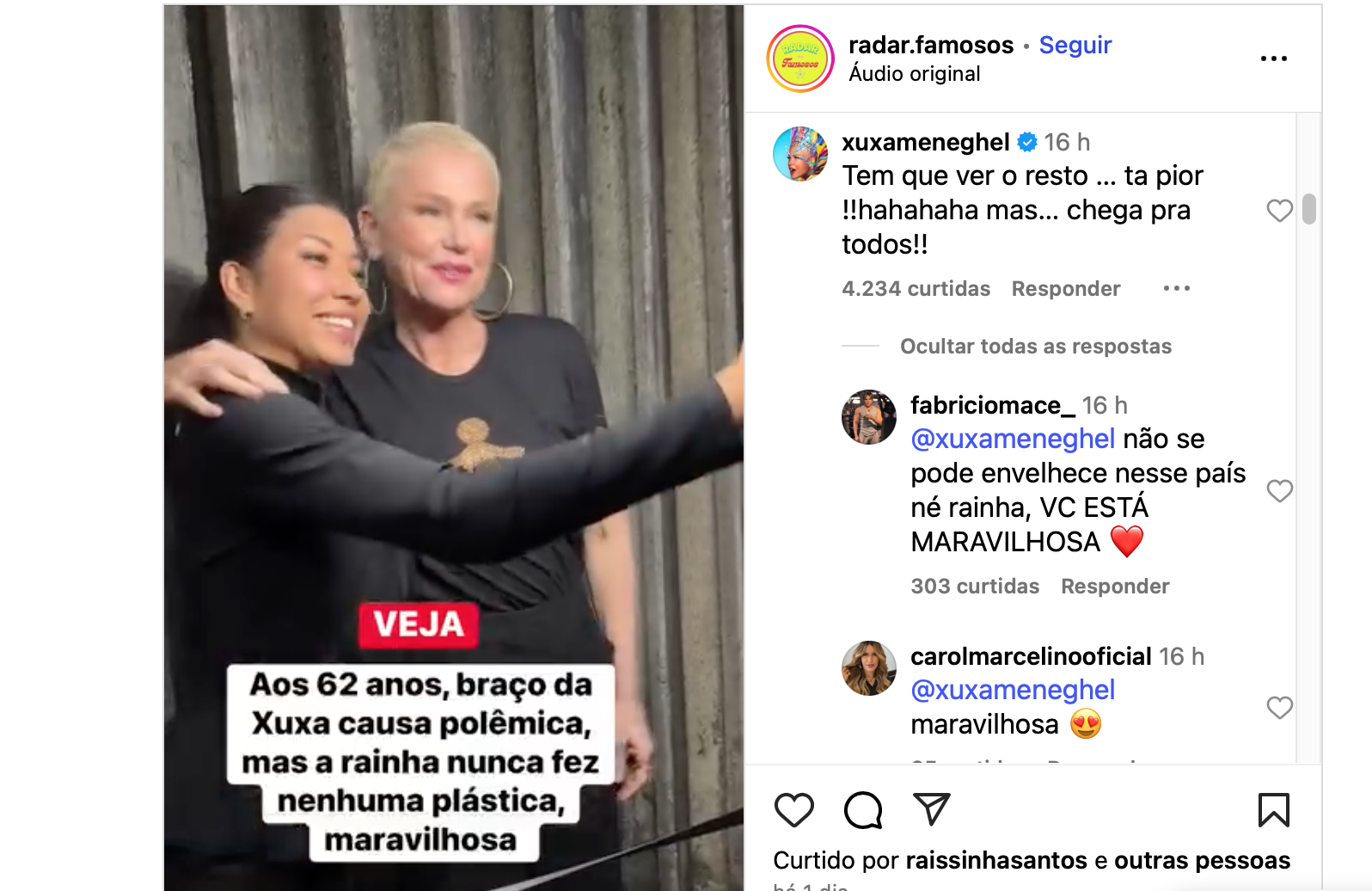 Xuxa Meneghel ironiza comentários sobre flacidez no braço: “O resto tá pior”