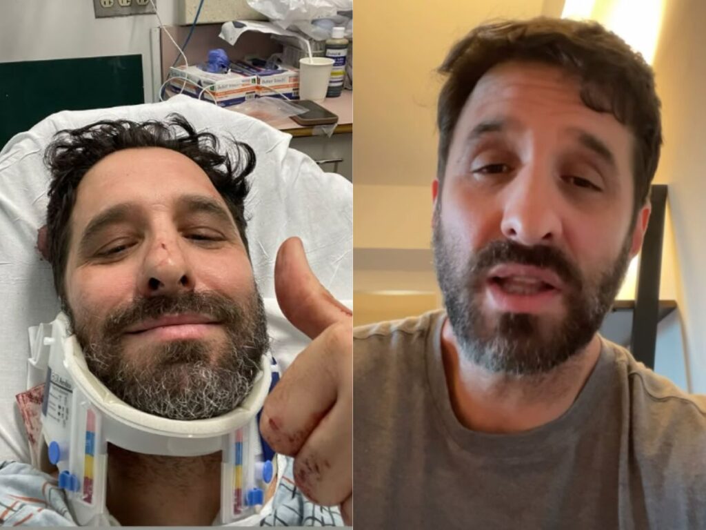 rafinha-bastos-sofre-acidente-de-bicicleta-e-quebra-clavicula-em-nova-york