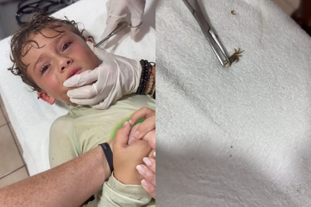 crianca-tem-caranguejo-vivo-retirado-do-ouvido-apos-banho-de-mar