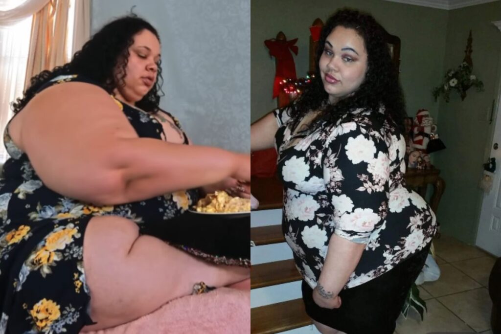 veja-antes-e-depois-de-ex-estrela-de-reality-que-pesava-289-quilos