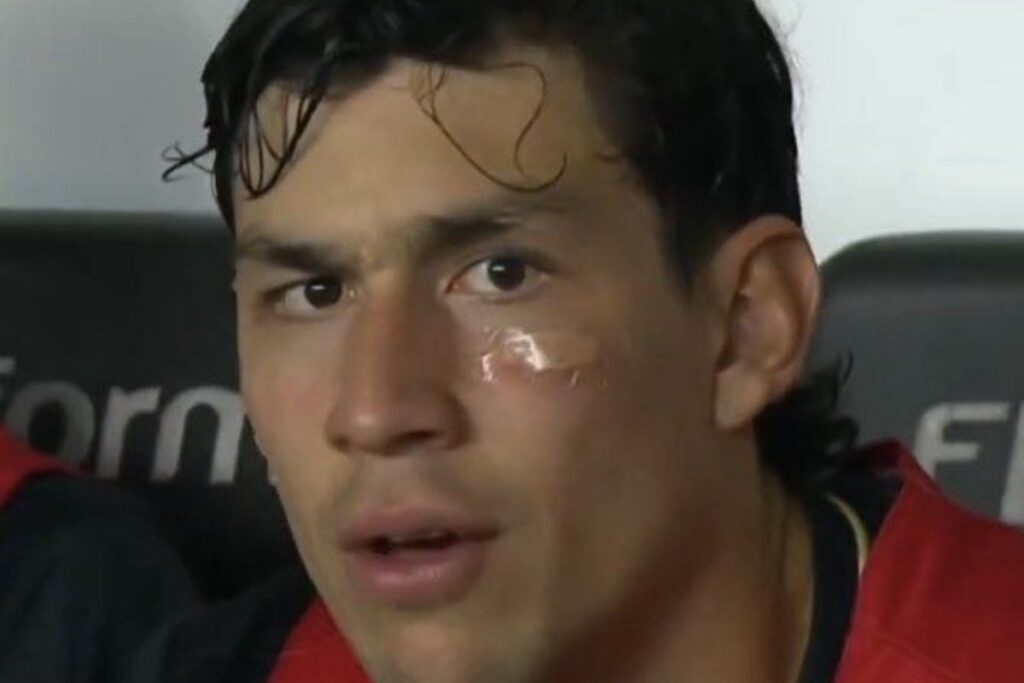 ferraresi-se-choca-com-companheiro-de-time-e-leva-dois-pontos-no-rosto