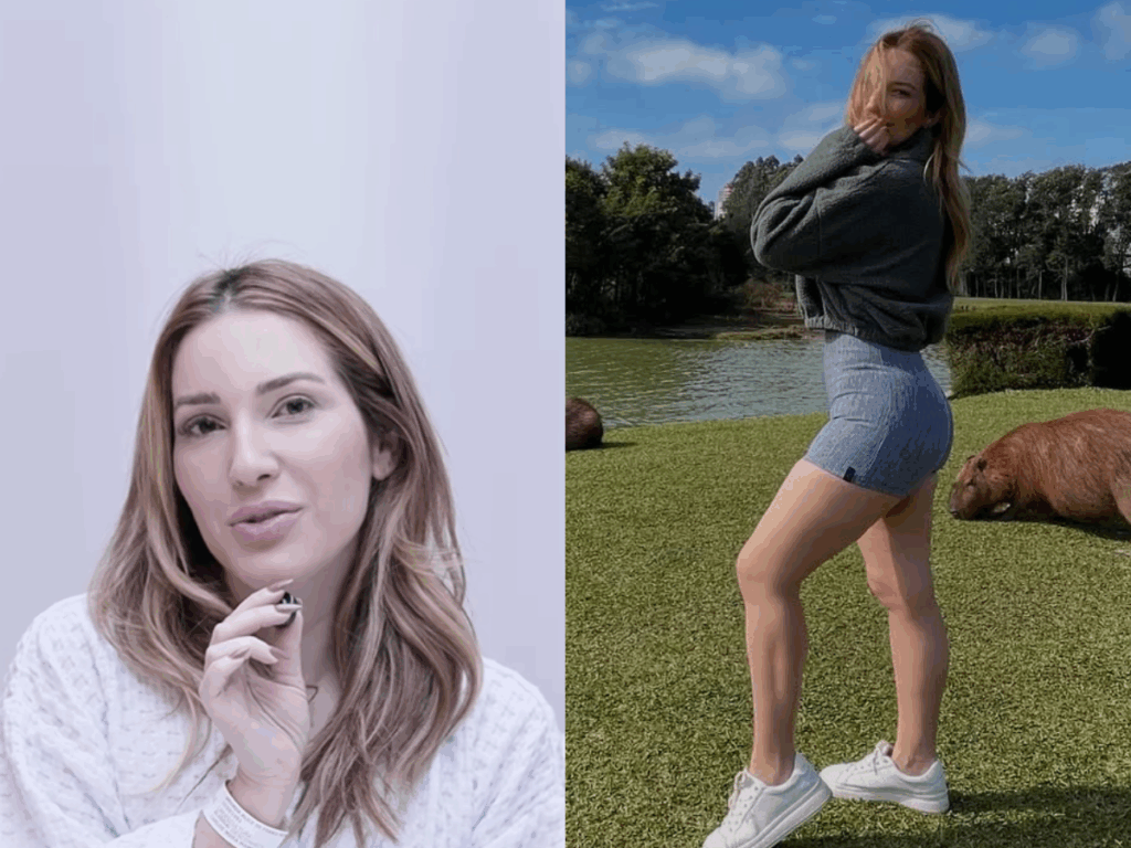 medica-explica-cirurgia-de-lipedema-feita-na-ex-bbb-amanda-meirelles:-“preventiva”