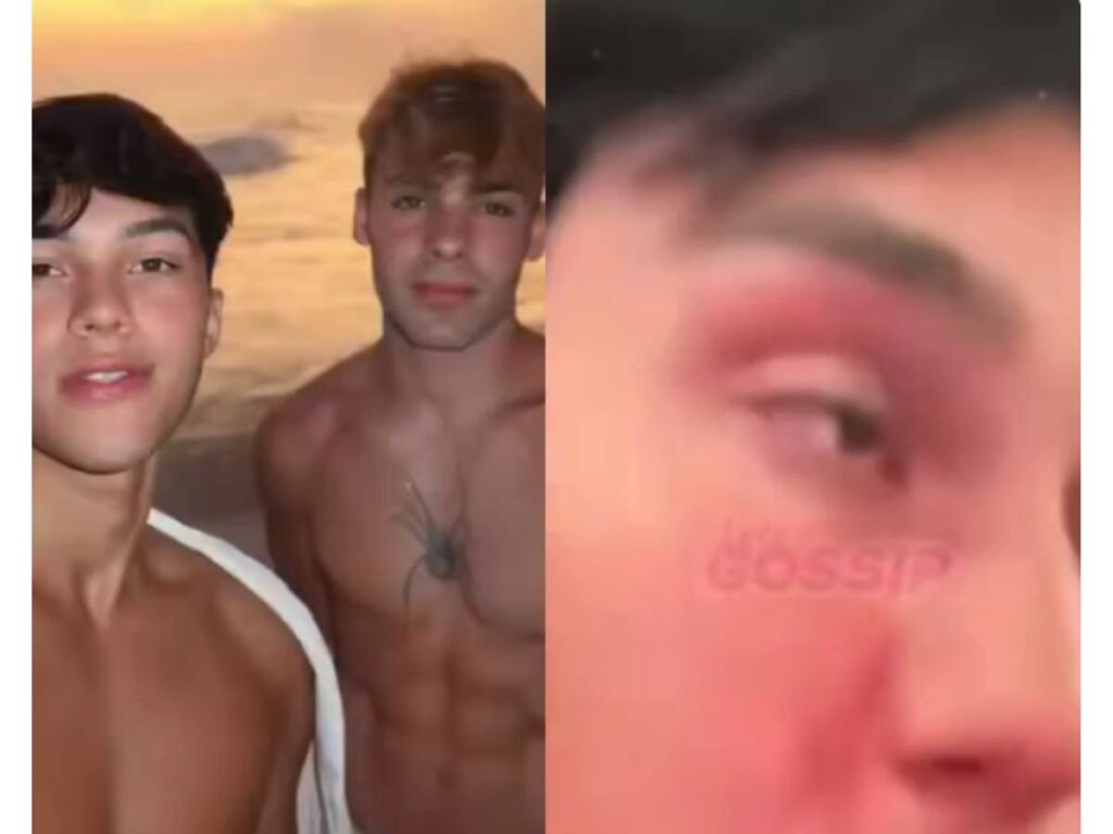 influenciador-e-acusado-de-agredir-namorado-na-europa:-“eu-to-destruido”