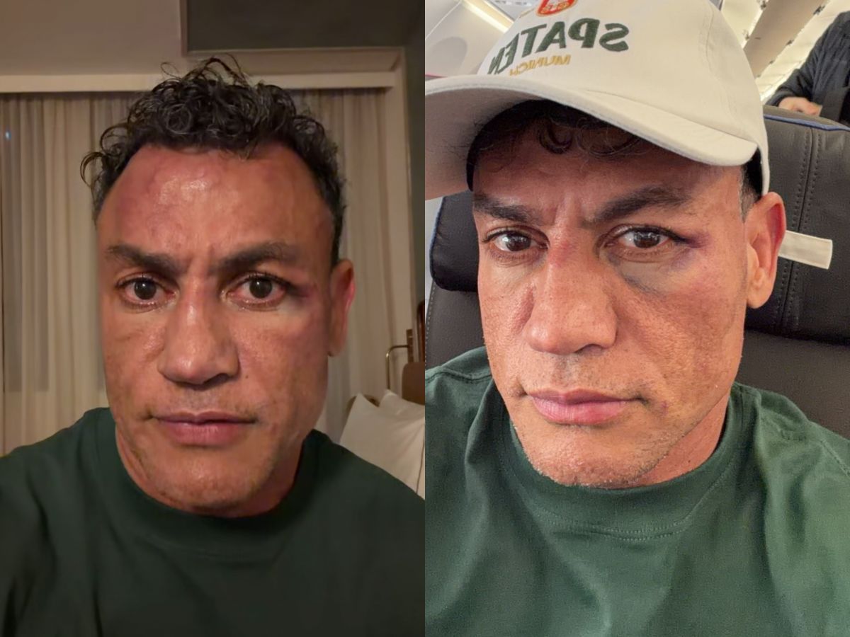Popó revela se toparia revanche com Wanderlei após confusão no ringue: “envergonhado”