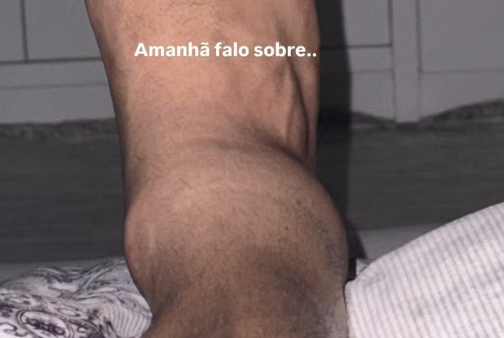 Marido de Simone Mendes sofre lesão e é hospitalizado no mesmo dia que a cantora