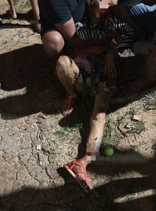 Idosa sofre fratura exposta em acidente de trânsito na entrada do bairro Vitória, em Sena Madureira
