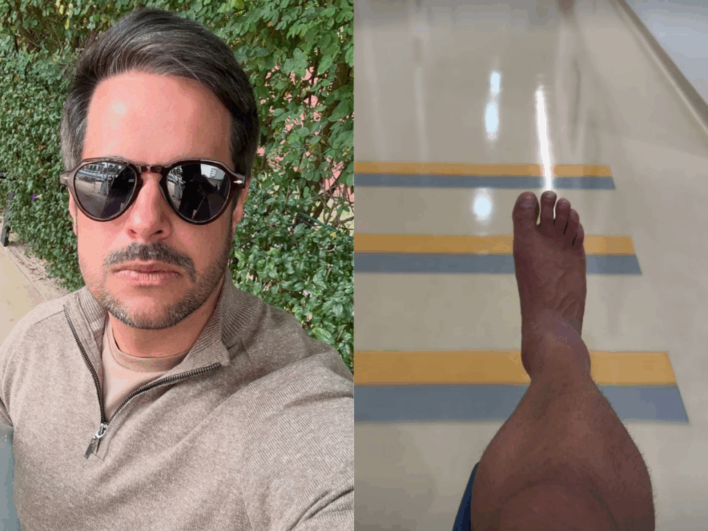 kaka-diniz-detalha-recuperacao-apos-grave-lesao-no-tornozelo:-“um-mes-e-meio-sem-pisar”