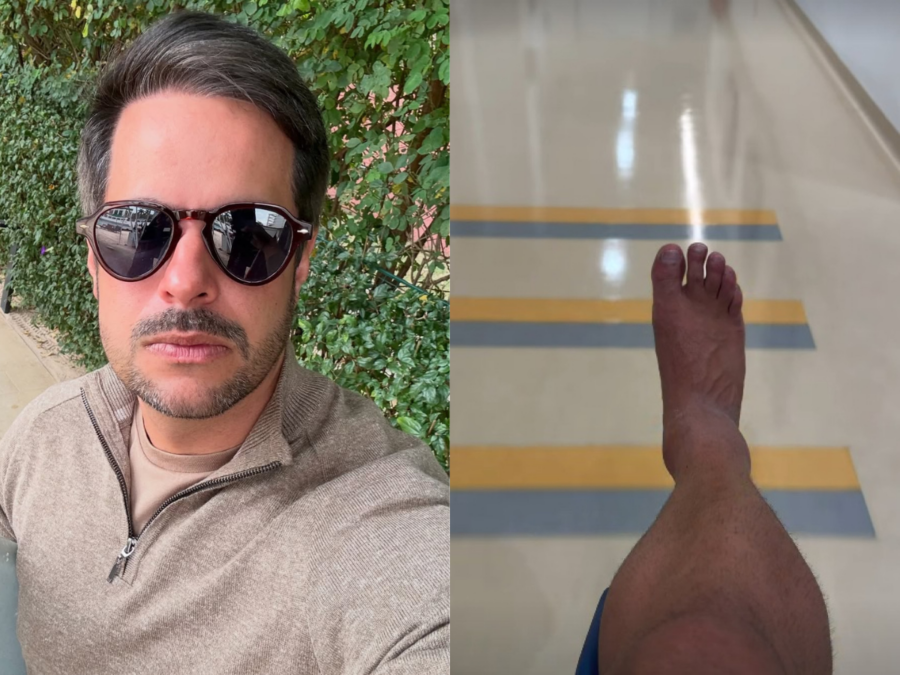 Kaká Diniz detalha recuperação após grave lesão no tornozelo: “Um mês e meio sem pisar”