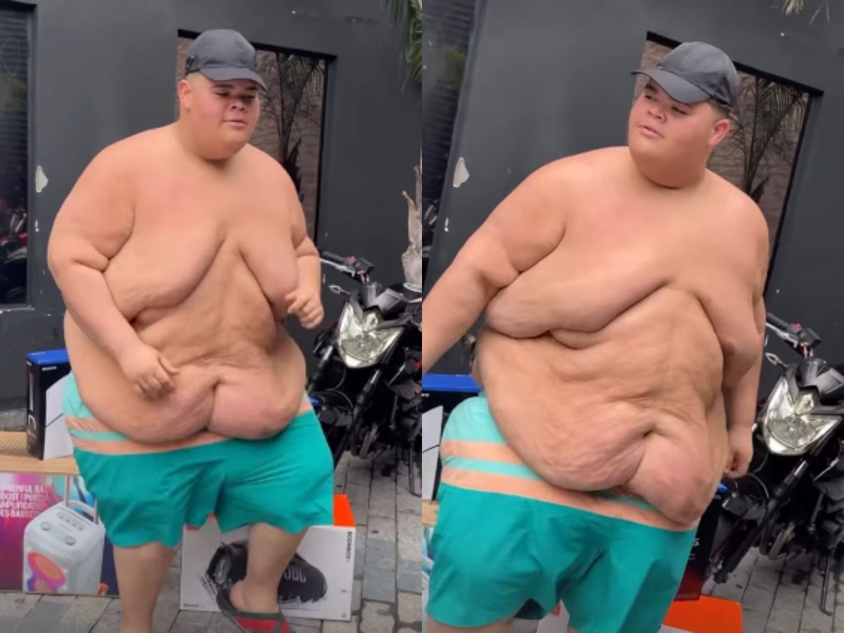 Influenciador Gordão da XJ exibe nova forma após perder mais de 115 kg