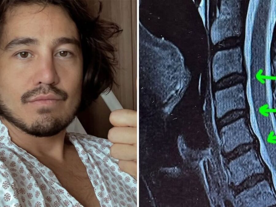 Tiago Iorc atualiza estado de saúde após grave crise de hérnia: “50% menos de dor”