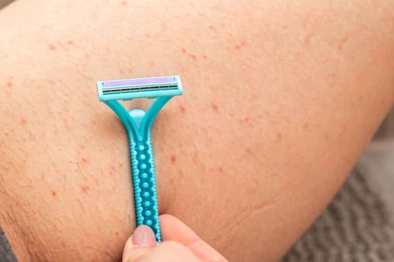 foliculite-tem-solucao:-medico-da-dicas-para-prevenir-e-tratar
