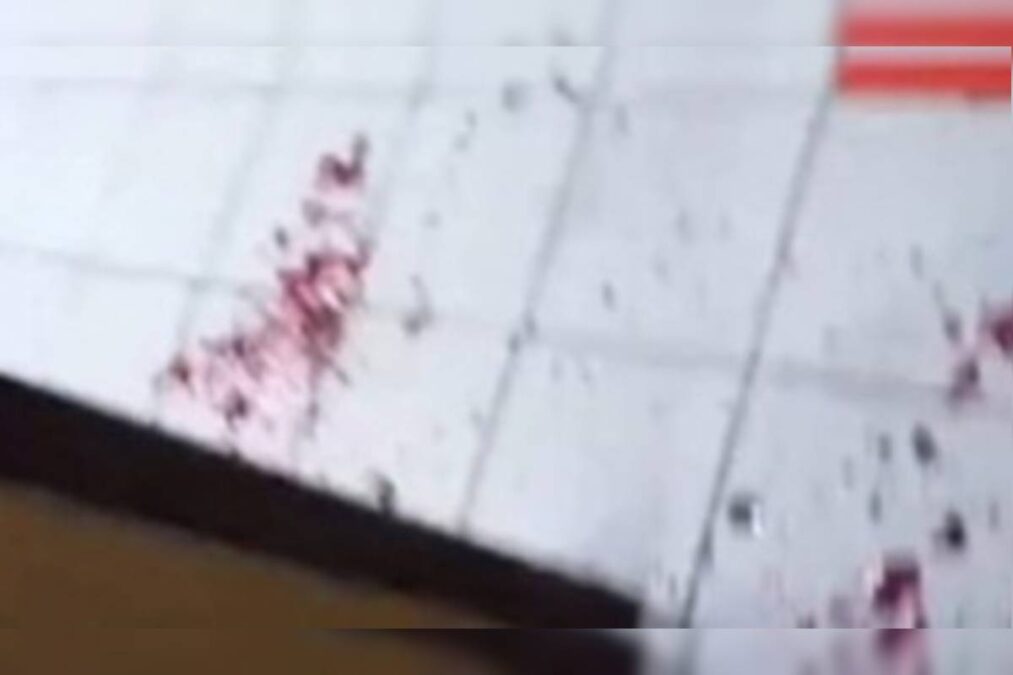 Idosa é atacada por pit-bull solto na rua e salva por jovens em Goiás