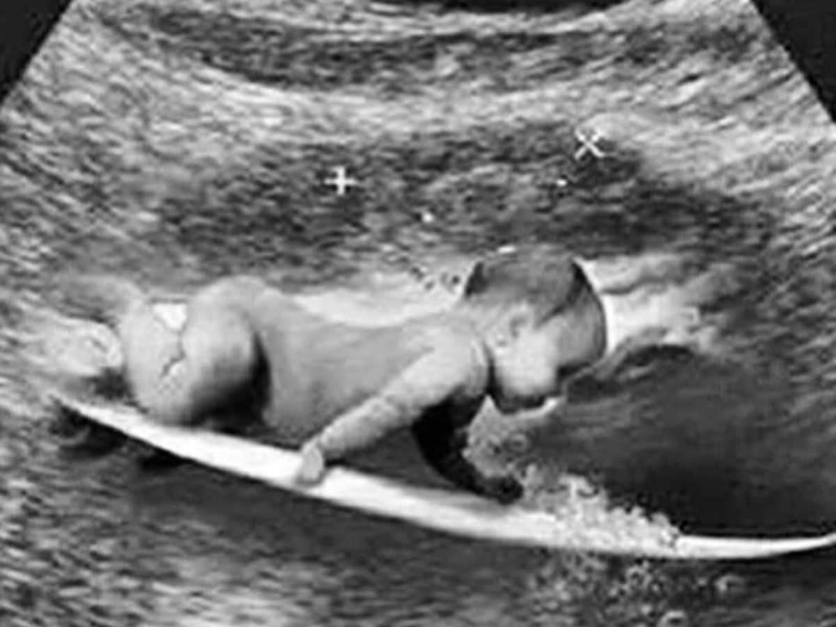 Papai do ano? Gabriel Medina levanta rumores após post enigmático