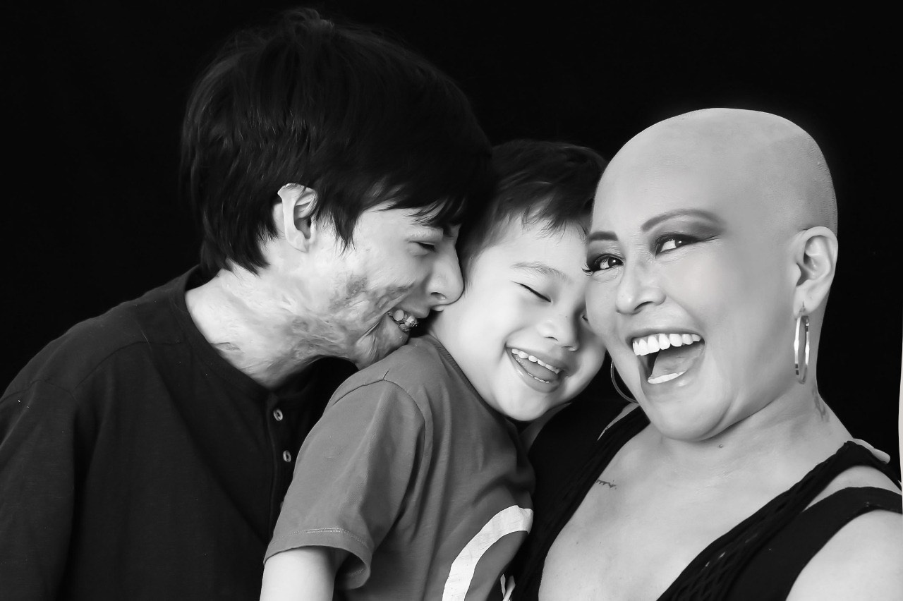 cancer-de-mama:-1-em-cada-3-casos-sao-de-mulheres-abaixo-dos-50-anos