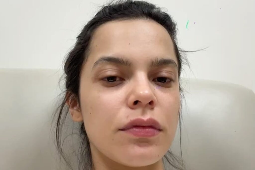 ex-bbb-e-internada-apos-sofrer-inflamacao-provocada-por-contraceptivo