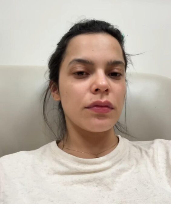 Ex-BBB é internada após sofrer inflamação provocada por contraceptivo: “Dias de dor”