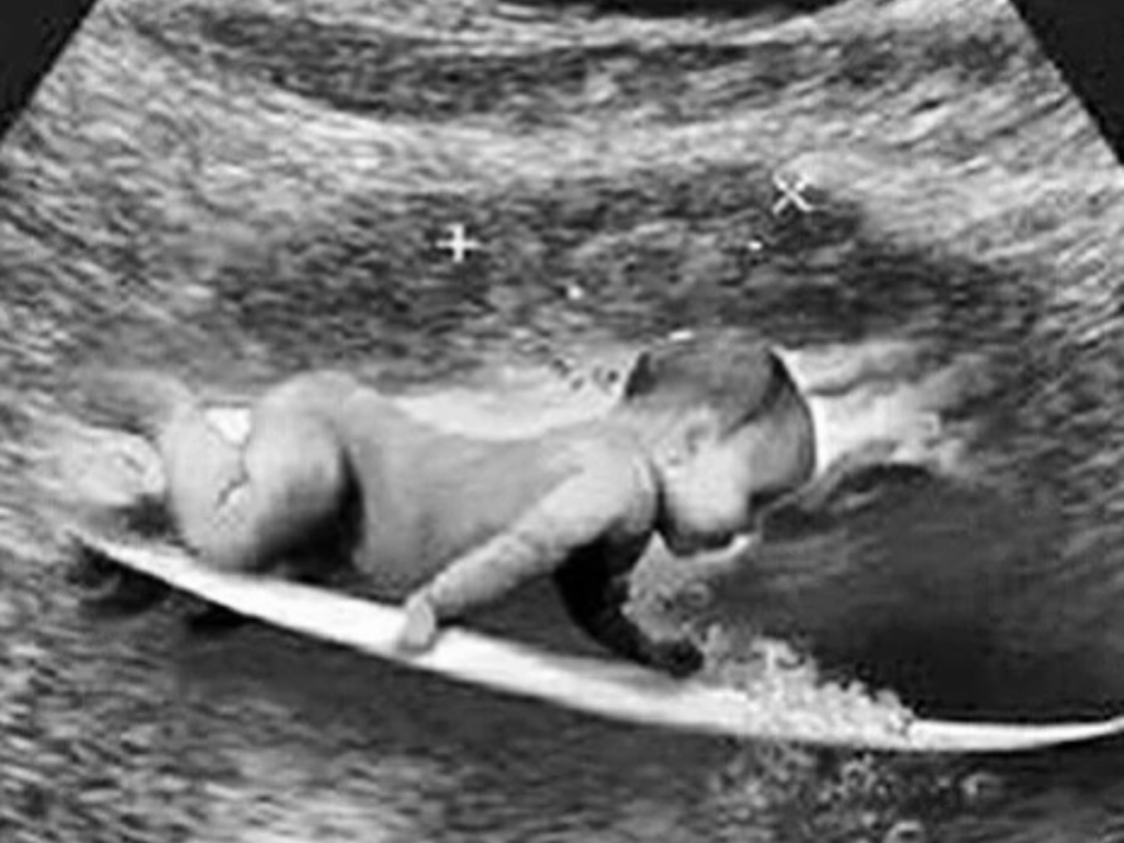 gravidez?-coisa-nenhuma!-isabella-arantes-e-medina-fingiram-gestacao-para-promover-marca