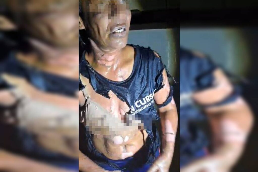 mulher-e-vitima-de-tentativa-de-feminicidio:-“ele-tacou-fogo-em-mim”