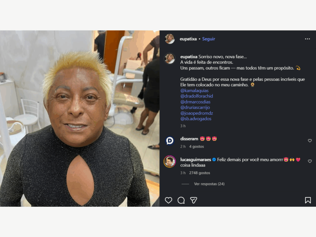 patixa-telo-coloca-implantes-dentarios-e-exibe-o-resultado.-veja-o-antes-e-depois!